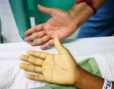 Méconnaissance des compléments alimentaires